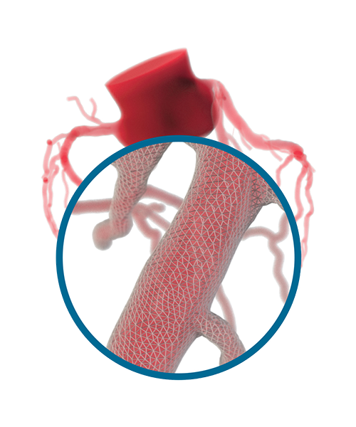 HeartFlow 3D Physiologic Assessment