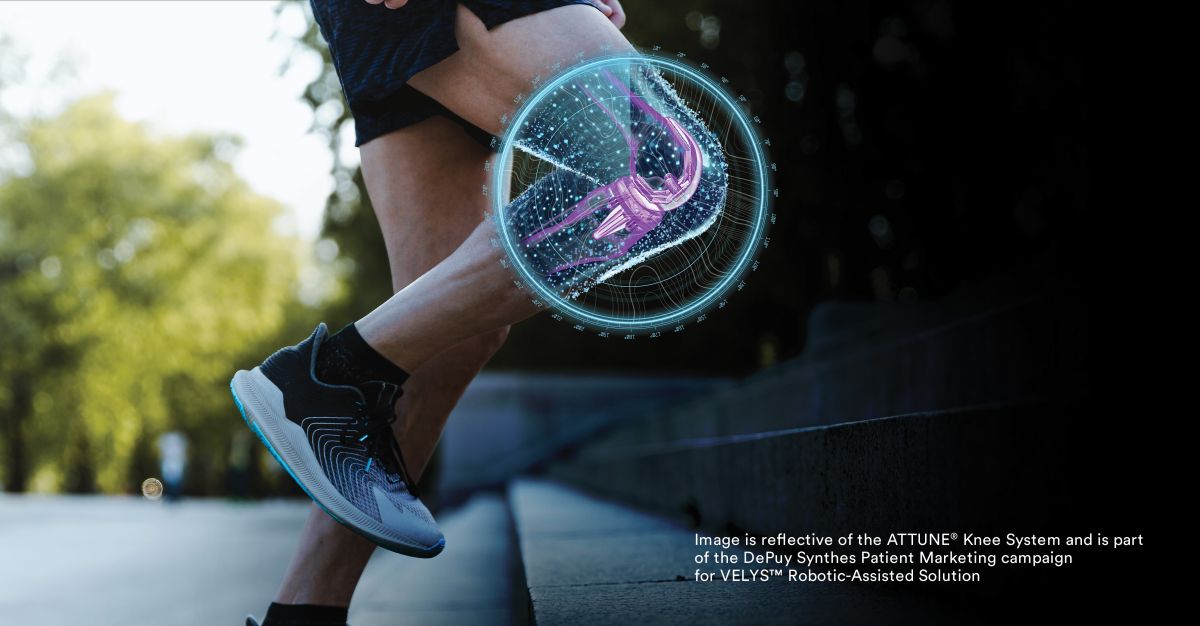 Image is reflective of the ATTUNE Knee System and is part of the DePuy Synthes Patient Marketing campaign for VELYS Robotic-Assisted Solution